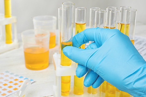 Urine in Tubes